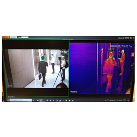 Thermal camera for body temperature detection