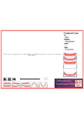 Multiple step 3D model of orthodontic treatment cases.