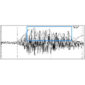 Emotion recognition technology