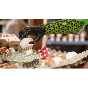 MyoPlus（マイオプラス）コントロールを備えたBebionic筋電義手