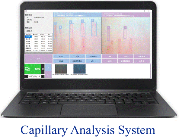 毛細血管スコープ（血流スコープ）画像解析ソフト