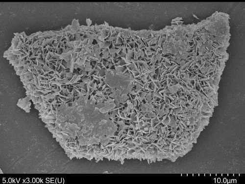 選択吸着機能「ハイドロキシアパタイト」化粧品開発者向け※事例進呈