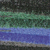 ろ過媒体『MATALAろ過媒体』