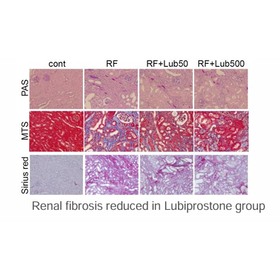 Tohoku Univ. Technology：Renal function improving agent：T13-090