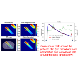 Tohoku Univ. Technology：Quick dose calculation algorithm under magnetic field using deep learning：T20-199