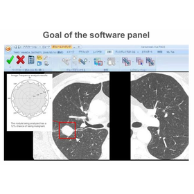 Tohoku Univ. Technology: Medical image analysis method and program: T24-071