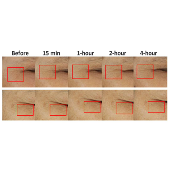 シワ改善＆肌荒れ改善の新規ペプチド