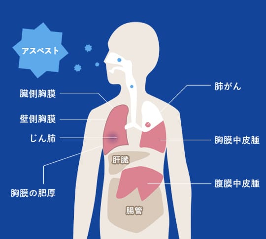 3ステップでわかるアスベストの基本