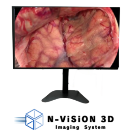 N-Vision 3Dイメージング・システム