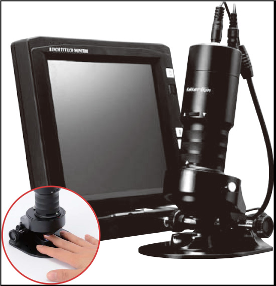 毛細血管スコープ（血流スコープ）【毛細血管の血流を観察可能！】