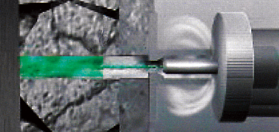 内圧充填接合補強工法