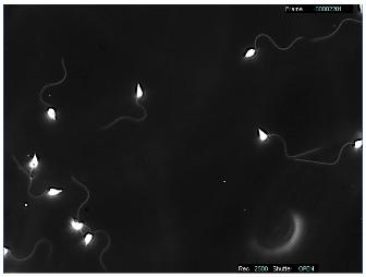 精子の動作解析【ハイスピードカメラ応用例】