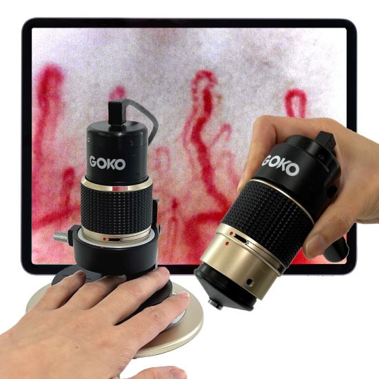  血流の可視化で自社製品の効果をPR　GOKO Bscan-ZD